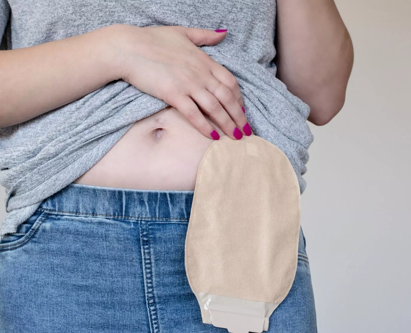 What to Wear for Ostomates - QLD Stoma Association